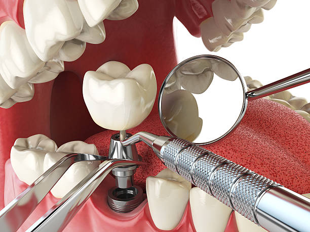 Best Emergency Gum Treatment in Clio, MI
