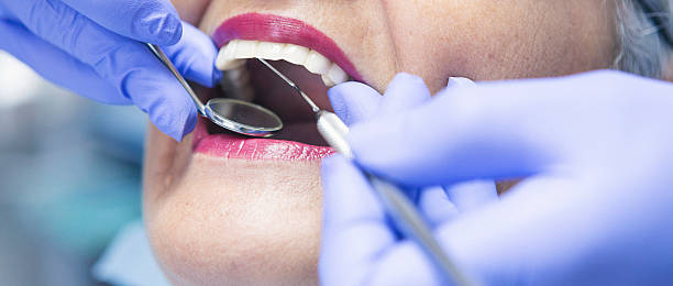 Best Emergency Gum Treatment in Clio, MI